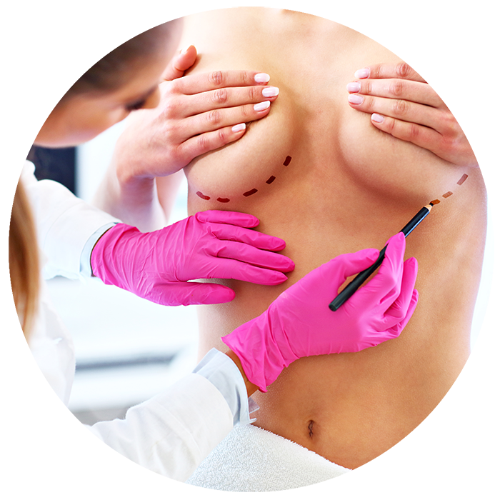 Breast-Lift